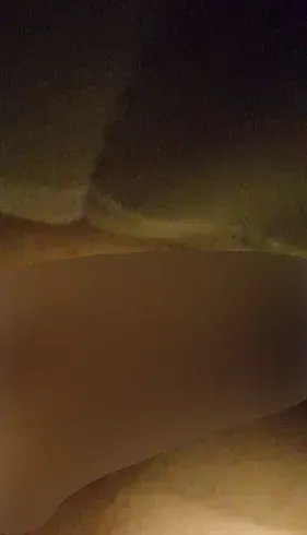 Mein arzt hat gesagt die nabel lässt sich nicht schließen Sie sollte offen bleiben