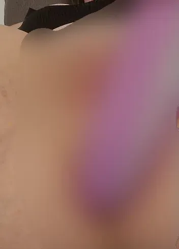 Finger im Po - Lunaline